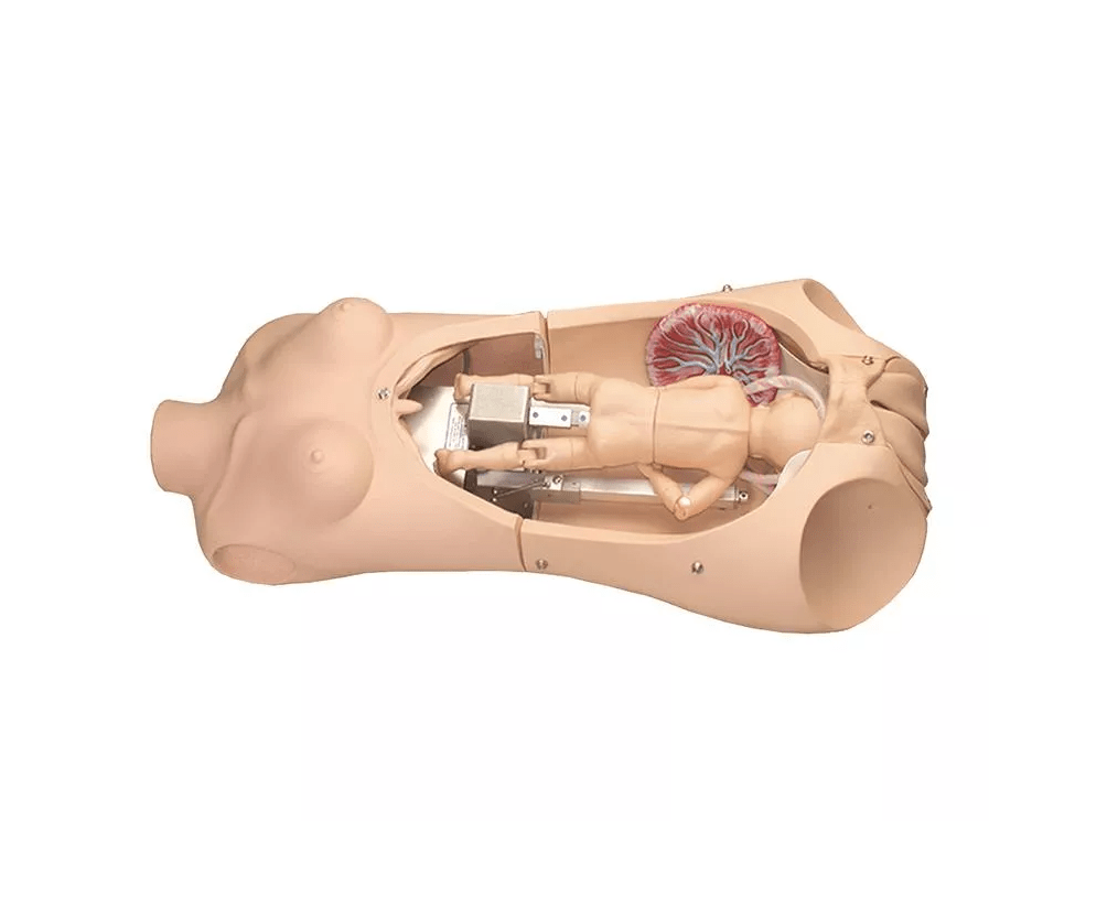 Noelle Geburtstorso - Erler - Zimmer